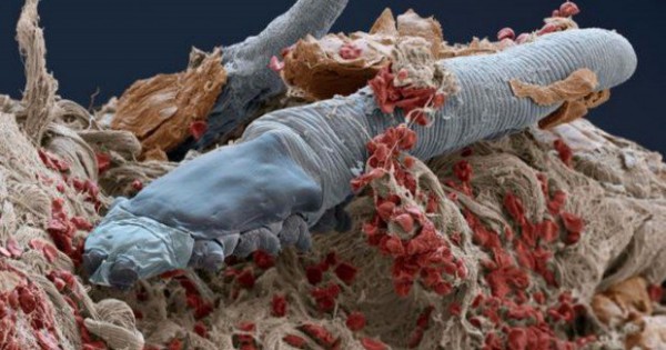 Αυτά τα μικροσκοπικά έντομα ζουν στο πρόσωπο όλων μας! (pics)