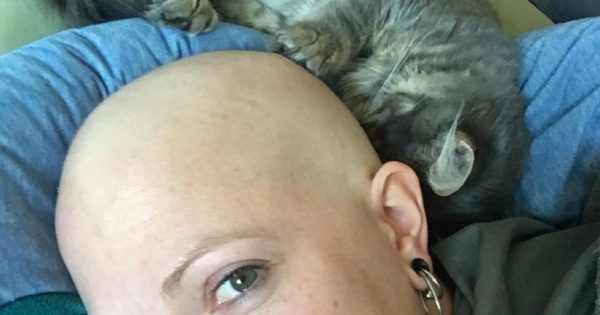 Έχασε τα μαλλιά της λόγω του καρκίνου αλλά η γατούλα της δεν την αφήνει μόνη