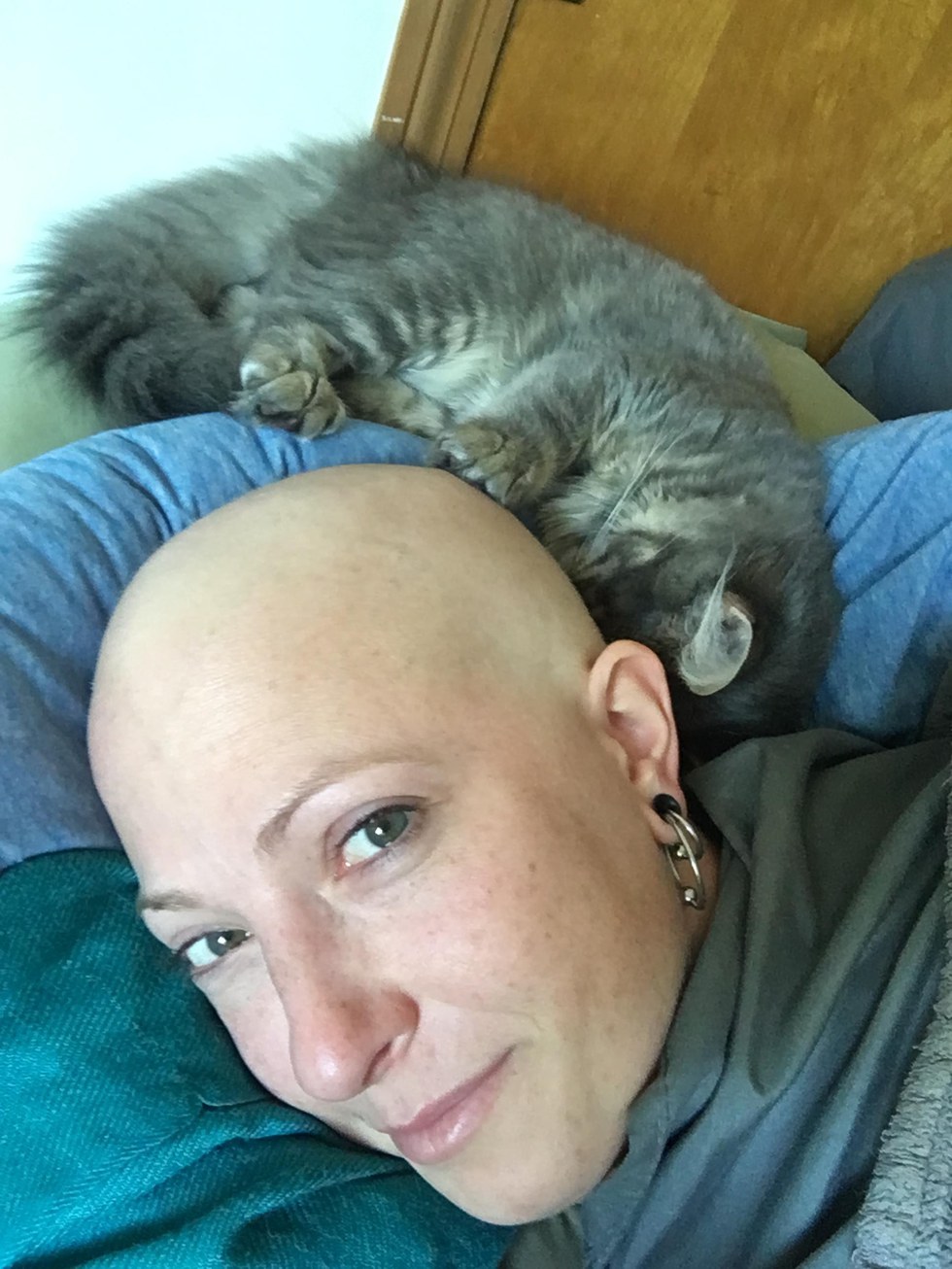 καρκίνος του μαστού Καρκίνος γατούλα γάτες γάτα καρκίνος Γάτα 