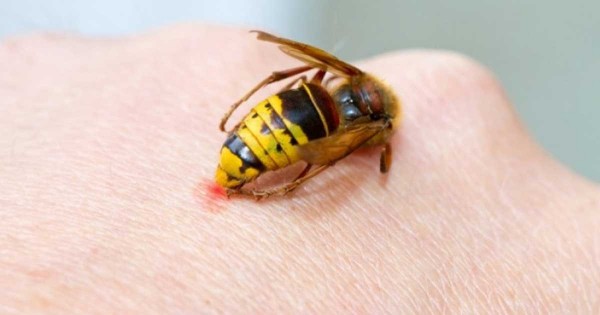 Τι πρέπει να κάνετε όταν σας τσιμπήσει σφήκα, μέλισσα ή σκορπιός;