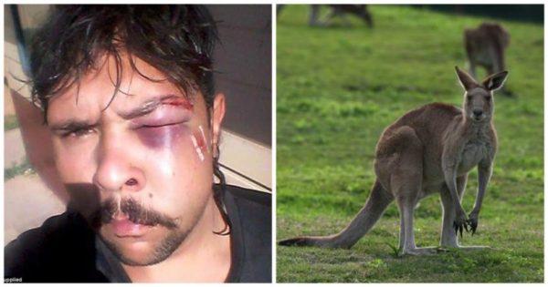 Κυνηγός προσπάθησε να σκοτώσει καγκουρό και το ζώο του επιτέθηκε και του βούλωσε το μάτι